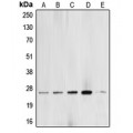 LifeSab™ BCAS2 Rabbit pAb (50 µl)