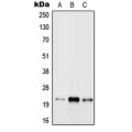 LifeSab™ RAB31 Rabbit pAb (50 µl)