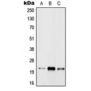 LifeSab™ RAB31 Rabbit pAb (50 µl)