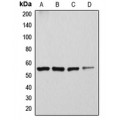 LifeSab™ ATP6V1H Rabbit pAb (50 µl)