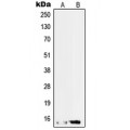 LifeSab™ SAP14 Rabbit pAb (50 µl)