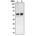 LifeSab™ CAMKV Rabbit pAb (50 µl)
