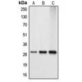 LifeSab™ APOA1BP Rabbit pAb (50 µl)