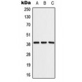 LifeSab™ ALDOB Rabbit pAb (50 µl)