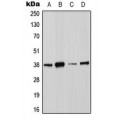 LifeSab™ Annexin A2 (pS26) Rabbit pAb (50 µl)