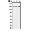 LifeSab™ Beta Amyloid (pT743) Rabbit pAb (50 µl)