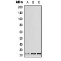 LifeSab™ ATF3 Rabbit pAb (50 µl)