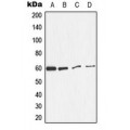 LifeSab™ Catalase (pY386) Rabbit pAb (50 µl)