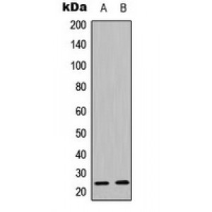 LifeSab™ Caveolin 1 (pY14) Rabbit pAb (50 µl)