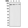 LifeSab™ CD143 Rabbit pAb (50 µl)