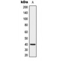 LifeSab™ DUSP1 Rabbit pAb (50 µl)