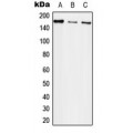 LifeSab™ EGFR Rabbit pAb (50 µl)