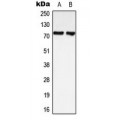 LifeSab™ LIMK1/2 Rabbit pAb (50 µl)