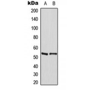 LifeSab™ MEF2A (pT319) Rabbit pAb (50 µl)