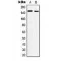 LifeSab™ c-Met (pY1234) Rabbit pAb (50 µl)