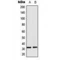 LifeSab™ RPS6 (pS235) Rabbit pAb (50 µl)