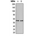 LifeSab™ HBP1 Rabbit pAb (50 µl)