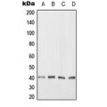 LifeSab™ ANKRD1 Rabbit pAb (50 µl)