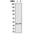 LifeSab™ MKK1/2 (pS218/222) Rabbit pAb (50 µl)