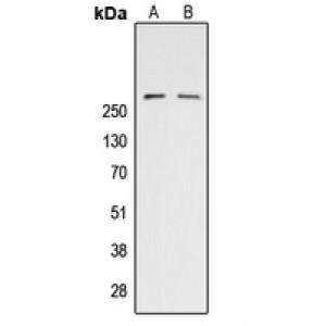 LifeSab™ ACC alpha (pS80) Rabbit pAb (50 µl)