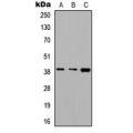 LifeSab™ ALDOC Rabbit pAb (50 µl)