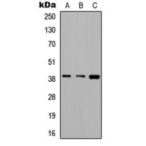 LifeSab™ ALDOC Rabbit pAb (50 µl)