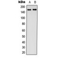 LifeSab™ CFTR Rabbit pAb (50 µl)