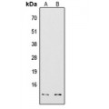 LifeSab™ COX7A2/3 Rabbit pAb (50 µl)