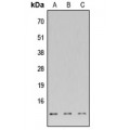 LifeSab™ DNAL4 Rabbit pAb (50 µl)