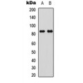 LifeSab™ GYS1 (pS645) Rabbit pAb (50 µl)