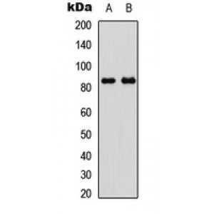 LifeSab™ GYS1 (pS645) Rabbit pAb (50 µl)