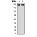 LifeSab™ MEKK1 (pT1402) Rabbit pAb (50 µl)