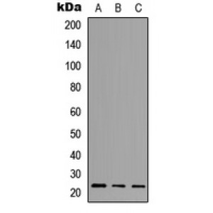 LifeSab™ NCALD Rabbit pAb (50 µl)