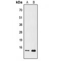 LifeSab™ PFDN1 Rabbit pAb (50 µl)