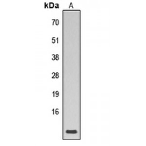 LifeSab™ Phospholamban (pS16/T17) Rabbit pAb (50 µl)