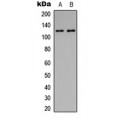 LifeSab™ Focal Adhesion Kinase (pY397) Rabbit pAb (50 µl)