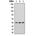 LifeSab™ PTP1B (pS50) Rabbit pAb (50 µl)