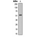 LifeSab™ SMAD3 (pT179) Rabbit pAb (50 µl)