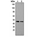 LifeSab™ Tachykinin Receptor 1 Rabbit pAb (50 µl)