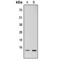 LifeSab™ TAF13 Rabbit pAb (50 µl)