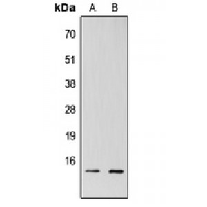 LifeSab™ TAF13 Rabbit pAb (50 µl)