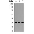 LifeSab™ cTnI Rabbit pAb (50 µl)
