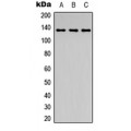 LifeSab™ ABL1 (pY204) Rabbit pAb (50 µl)