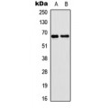 LifeSab™ EPN2 Rabbit pAb (50 µl)