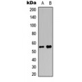 LifeSab™ MEF2D (pS444) Rabbit pAb (50 µl)