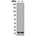 LifeSab™ RAB6A Rabbit pAb (50 µl)