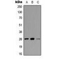 LifeSab™ cTnI (pS22/S23) Rabbit pAb (50 µl)