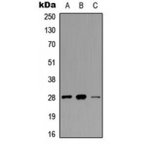 LifeSab™ cTnI (pS22/S23) Rabbit pAb (50 µl)