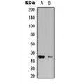 LifeSab™ VASP (pS238) Rabbit pAb (50 µl)
