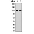 LifeSab™ Aconitase 1 (pS711) Rabbit pAb (50 µl)